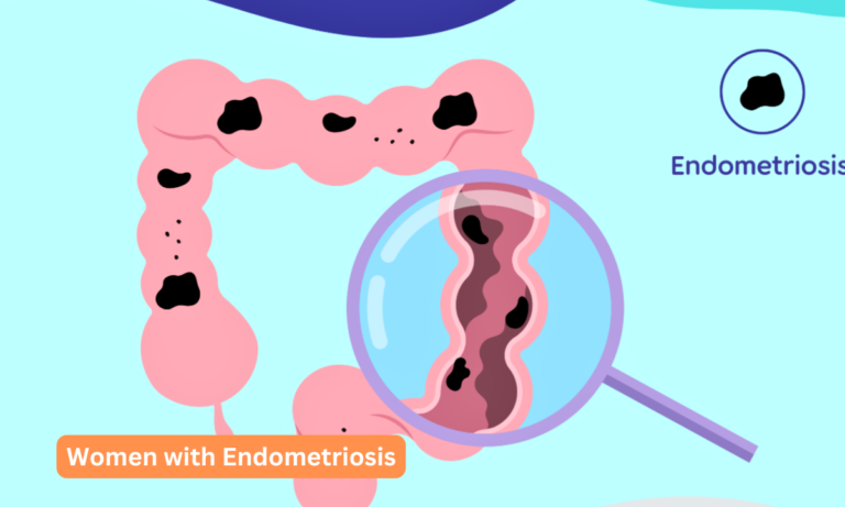 Women with Endometriosis